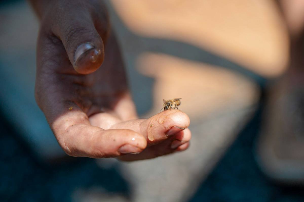 Bienenstich: Was wirklich hilft – und was du vermeiden solltest